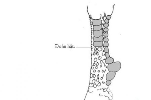 đoản hậu